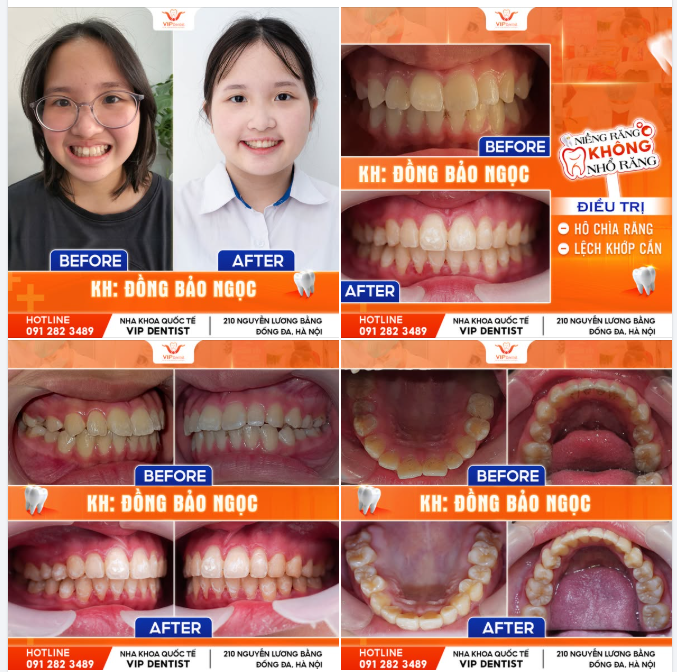 THAY ĐỔI NHỎ - LỢI ÍCH LỚN!