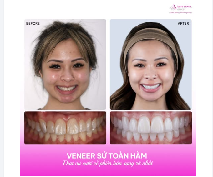 4 BUỔI HẸN & PHIÊN BẢN "KHÔNG TÌ VẾT" CỦA NỤ CƯỜI ĐIỂM 10