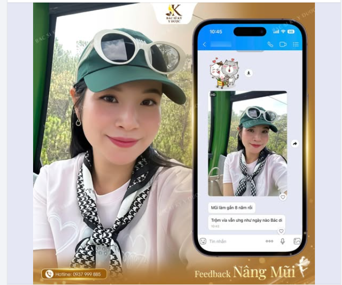 8 Năm – Một Dáng Mũi – Triệu Sự Tự Tin