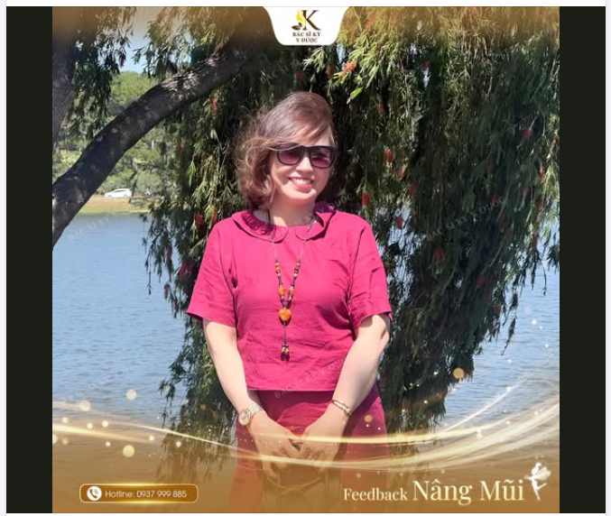 Dáng mũi Aline – Nâng tầm nhan sắc