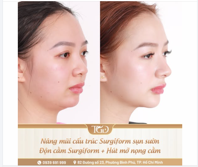 Sở hữu góc nghiêng “đắt giá” bắt đầu từ combo 3 trong 1