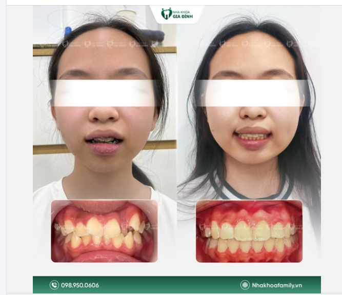AI RỒI CŨNG CÓ MỘT NỤ CƯỜI XỨNG ĐÁNG ĐỂ CHỜ ĐỢI