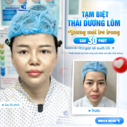TẠM BIỆT THÁI DƯƠNG LÕM - GƯƠNG MẶT TRẺ TRUNG SAU 30 PHÚT