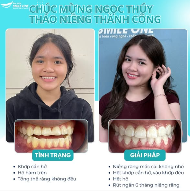 Nhiều người nghĩ làm răng xong sẽ đẹp hơn là điều quan trọng nhất.