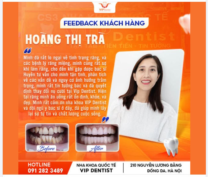 Cảm xúc khi có 1 nụ cười mới và những tâm sự sau khi trải nghiệm tại nha khoa Vip Dentist của chị Hoàng Thị Trà là những động lực rất lớn đối với đội ngũ của nha khoa Vip Dentist.