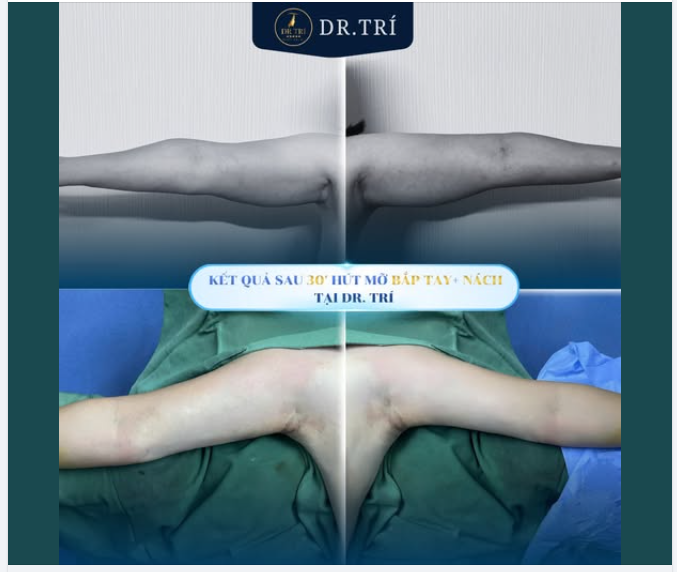 30 PHÚT CHO MỘT SỰ THAY ĐỔI NGOẠI MỤC!