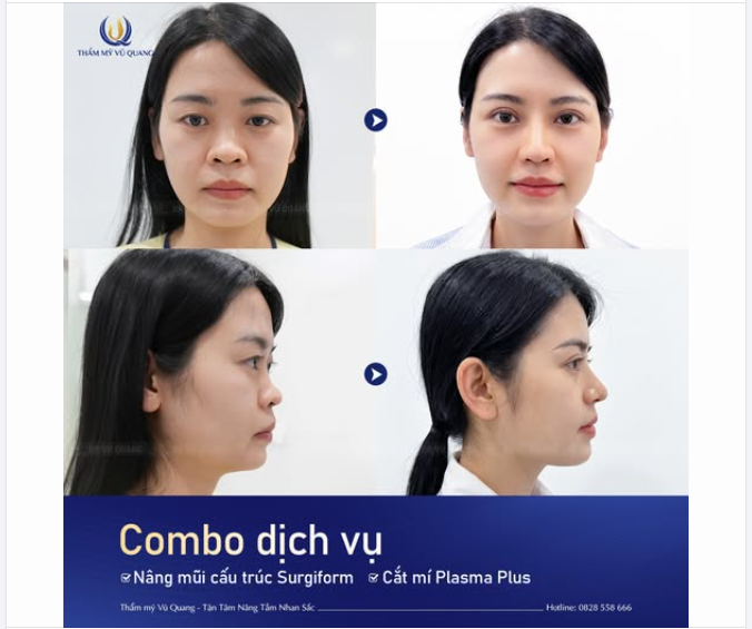 Nụ cười hài lòng chính là điều đẹp nhất sau hành trình thay đổi nhan sắc tại Thẩm mỹ Vũ Quang.
