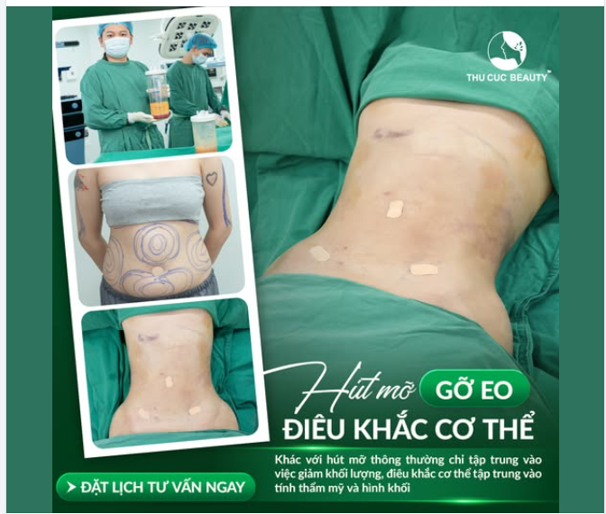 Eo thon gọn – body có đường nét tự nhiên