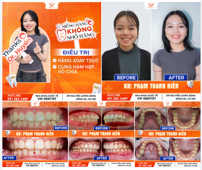 GƯƠNG MẶT RẠNG RỠ - NỤ CƯỜI TỰ TIN