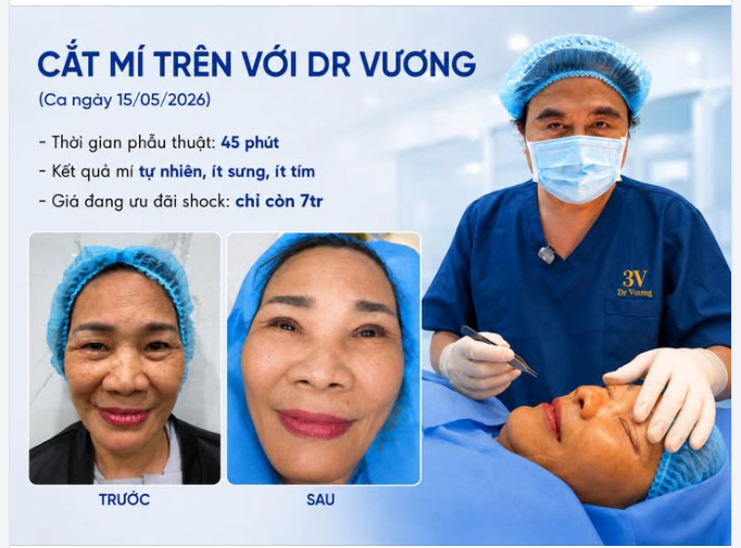 Ca ngày 15/05/2026: cắt mí trên cho chị gái đến từ Phường Dĩ An, TpHCM