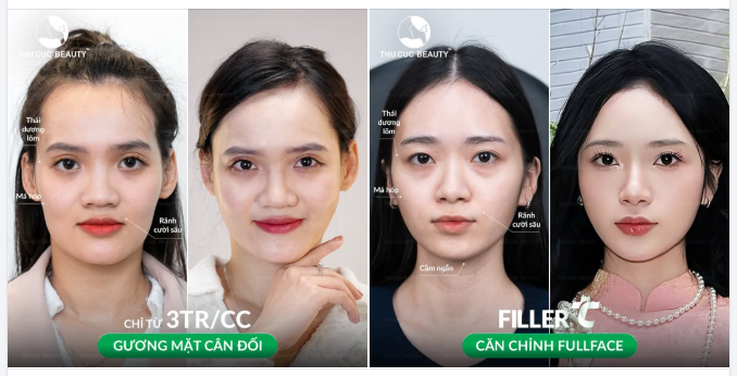Chọn Căn chỉnh Fullface - Filler TC để cảm nhận sự thay đổi bất ngờ