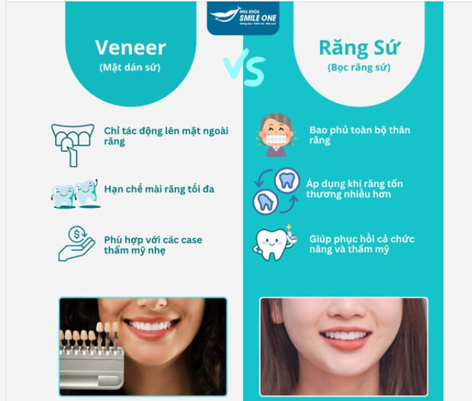 ĐỀU GỌI LÀ 'LÀM RĂNG SỨ' NHƯNG VENEER KHÁC GÌ BỌC RĂNG SỨ?