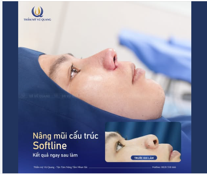 Nam tính, mạnh mẽ và đầy khí chất sau nâng mũi!