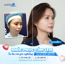 KHẮC PHỤC CẰM LẸM - TỰ TIN VỚI GÓC NGHIÊNG CUỐN HÚT