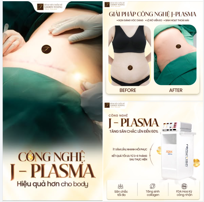 Hủy m-ỡ kết hợp J-Plasma - Bộ đôi hoàn hảo cho vóc dáng săn chắc lên đến 60%
