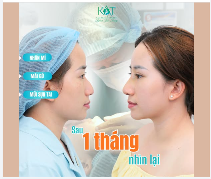 “Hơn 1 tháng nhìn lại… ai cũng thấy khác, nhưng không ai biết bạn đã đẹp lên từ lúc nào.”