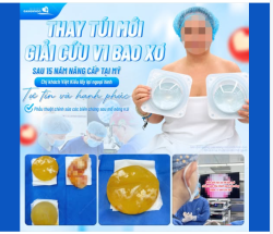 LẤY LẠI DÁNG V1 HÀI HÒA – TÌM LẠI SỰ TỰ TIN