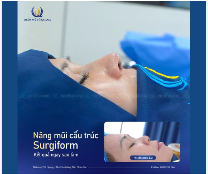 Xem rất nhiều dáng mũi, tìm hiểu qua không ít nơi… nhưng chị khách vẫn chưa thật sự dám quyết định.