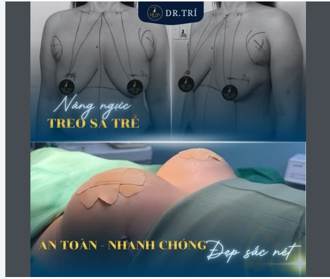 ẠM BIỆT VÒNG 1 CHẢY XỆ – HỒI SINH SỰ QUYẾN RŨ