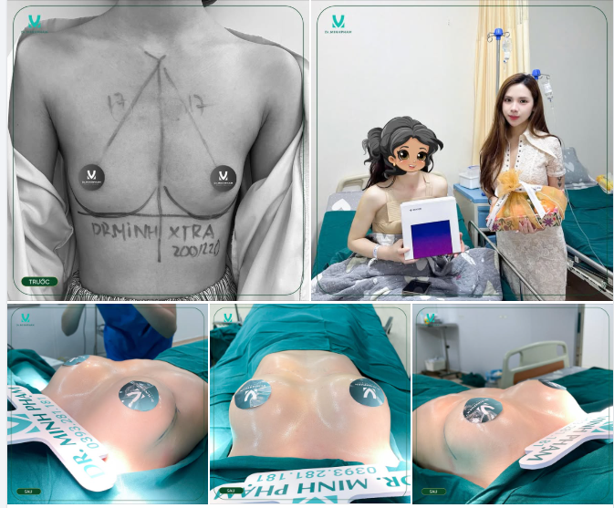 ĐIÊU KHẮC V1 TỰ NHIÊN ĐẾN TỪNG CHI TIẾT