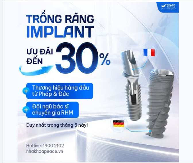 CƠ HỘI VÀNG: KHÔI PHỤC RĂNG MẤT - ƯU ĐÃI ĐẾN 30% CHỈ TRONG THÁNG 5!
