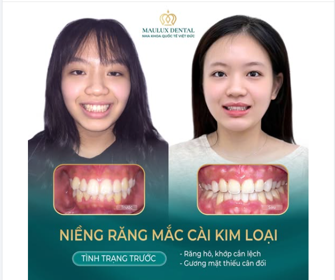CÓ NHỮNG NỤ CƯỜI NHÌN TƯỞNG ĐẸP… NHƯNG LẠI ĐANG “KÊU CỨU”
