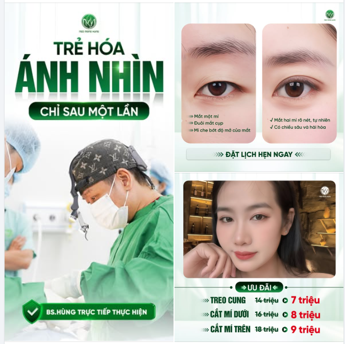 Dành cho KH đang gặp tình trạng mí chùng, sụp, một mí, mí không cân đối,...