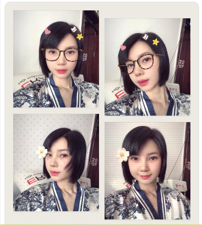 Xin cảm ơn Siêu mẫu Hạ Vy đã chọn Xuân Hương là nơi thực hiện combo: Nâng mũi - Cắt mí