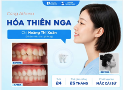 "KHÔNG NGỜ CÓ NGÀY EM ĐƯỢC HÓA THIÊN NGA NHƯ THẾ NÀY!"
