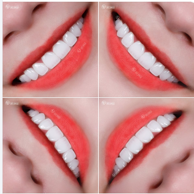 ĐẾN VIET SMILE MỖI NỤ CƯỜI LÀ MỘT PHIÊN BẢN