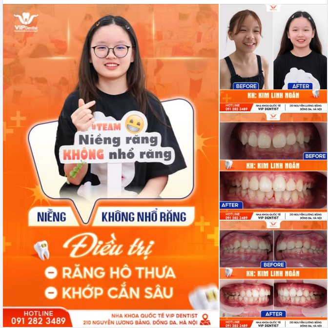 SAU 2 MÙA HÈ ĐEO MẮC CÀI - KIM LINH NGÂN ĐÃ CÓ NỤ CƯỜI RẠNG RỠ HƠN MẶT TRỜI RỒI NHA!