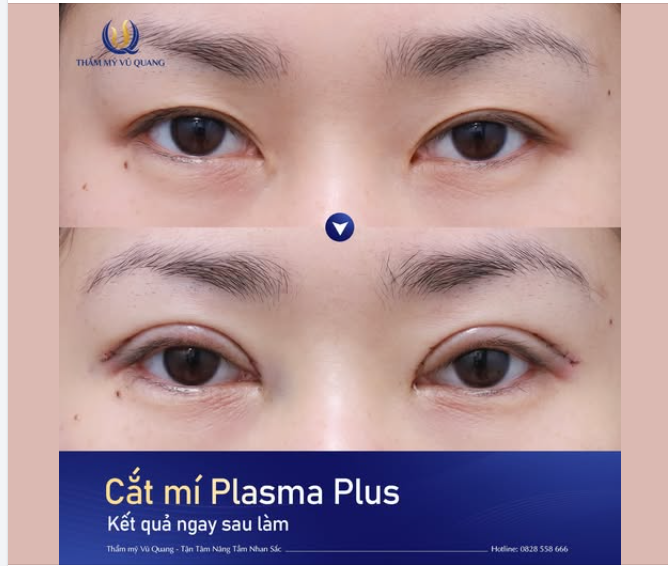 Cận cảnh dáng mí ngay sau thực hiện tại TMVQ