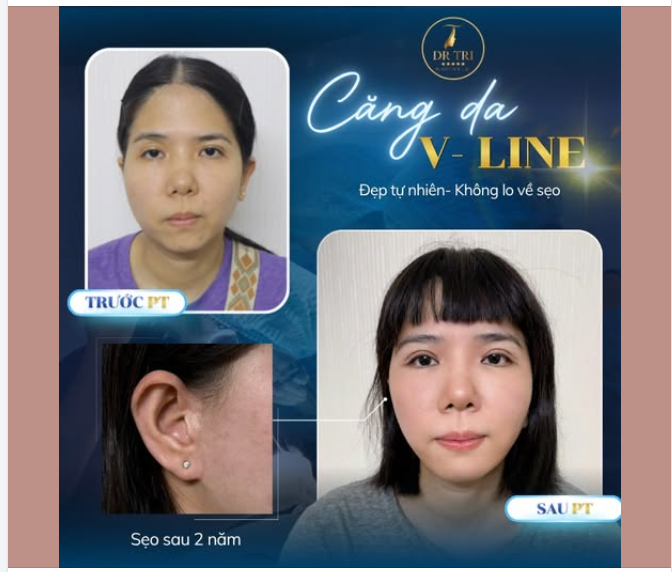 DA "LÃO HÓA NGƯỢC", NHAN SẮC THĂNG HẠNG CHỈ SAU 1 LẦN THỰC HIỆN