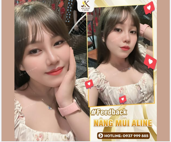 Mũi xinh là auto bật mood  Đi đâu cũng thấy mình nổi bật