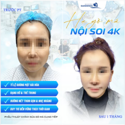 HẠ GÒ MÁ NỘI SOI 4K