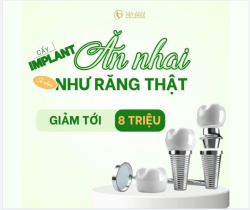 ƯU ĐÃI CHÀO HÈ – TRỒNG IMPLANT TIẾT KIỆM TỚI 8 TRIỆU ĐỒNG!