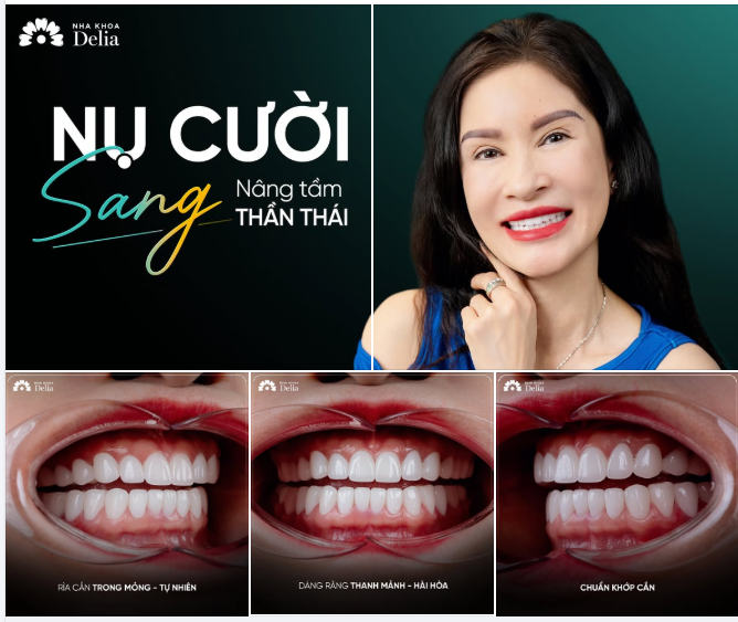 ĐẤT NƯỚC TRỌN NIỀM VUI – NỤ CƯỜI THÊM RẠNG RỠ