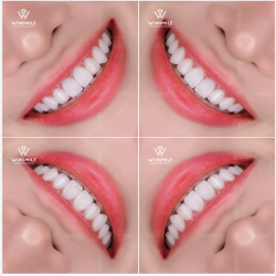 Đỉnh cao của sự thời thượng không phải là khoác lên mình những gì lộng lẫy nhất, mà là sở hữu những chi tiết khiến người ta không thể rời mắt nhưng chẳng thể gọi tên.