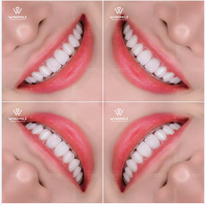 Đỉnh cao của sự thời thượng không phải là khoác lên mình những gì lộng lẫy nhất, mà là sở hữu những chi tiết khiến người ta không thể rời mắt nhưng chẳng thể gọi tên.