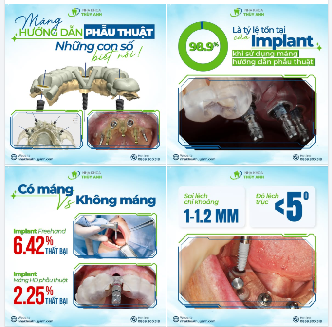 MÁNG HƯỚNG DẪN PHẪU THUẬT – NHỮNG CON SỐ BIẾT NÓI