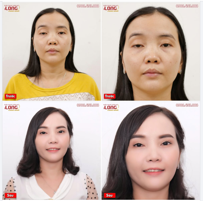 BÍ QUYẾT TRẺ RA 5 TUỔI NHỜ THAY ĐỔI ĐIỀU NÀY