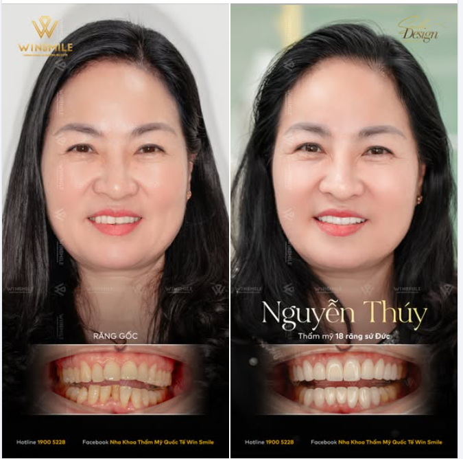 Người ta thường nói, nét đẹp của người phụ nữ ở độ tuổi trung niên nằm ở sự tĩnh lặng và khí chất từ sâu bên trong.