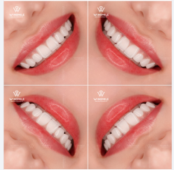 Một nụ cười tươi hài hòa, mang đậm dấu ấn cá nhân không chỉ giúp lấy lại vẻ tự tin, rạng ngời mà còn tôn vinh nét đẹp tự nhiên, độc bản trên từng gương mặt.