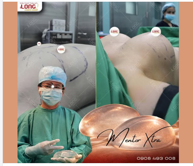 LỄ VỪA QUA HÈ LẠI ĐẾN RỒI  Nhả vía cho các chị em đang cần  Tiếp thêm động lực cho các chị em đang quan tâm