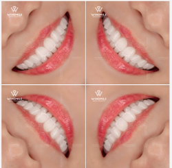 Nụ cười phản chiếu điều gì về một người? Với những vị khách của Win Smile, nụ cười là nơi thể hiện rõ nhất cái "gu" và chiều sâu thẩm mỹ cá nhân.