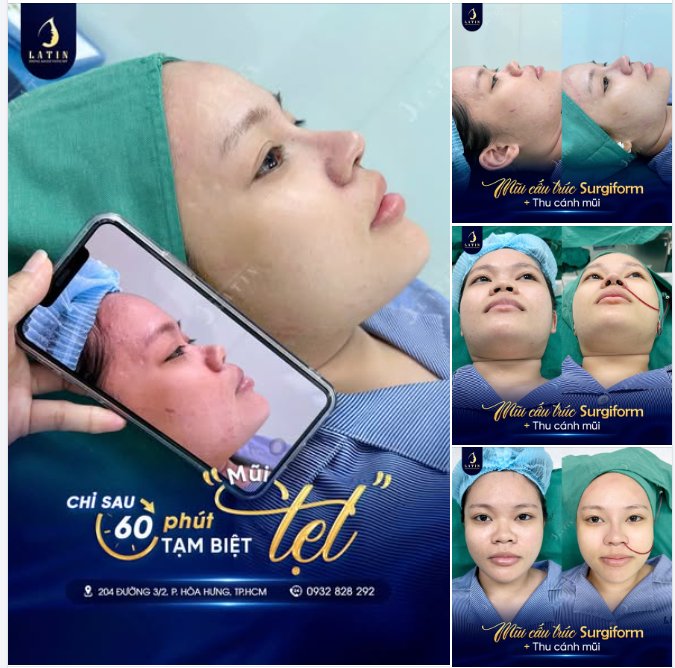 CHỈ 60 PHÚT – GƯƠNG MẶT THAY ĐỔI RÕ RỆT