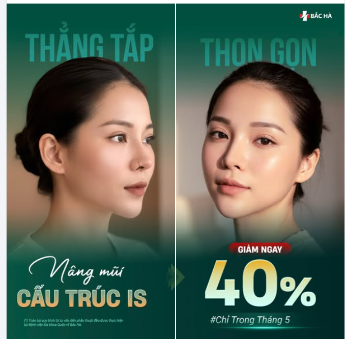 MŨI NHƯ THẾ NÀO MỚI ĐƯỢC GỌI LÀ ĐẸP?