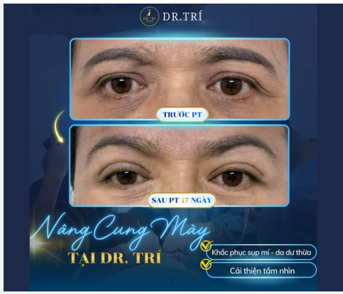 TRẺ RA 10 TUỔI CHỈ SAU 17 NGÀY