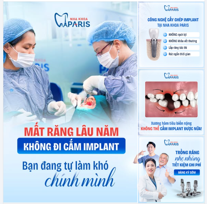 ĐỂ MẤT RĂNG LÂU NĂM KHÔNG ĐI CẮM IMPLANT - BẠN ĐANG TỰ LÀM KHÓ CHÍNH MÌNH!