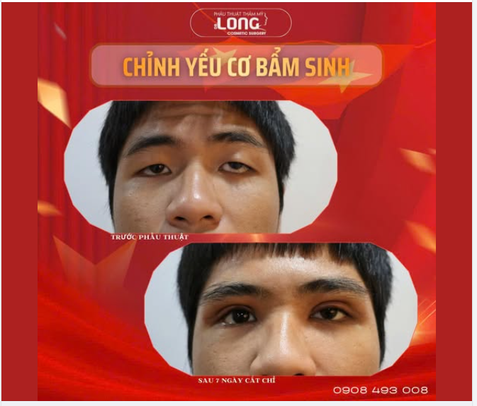 Có 1 chàng trai từng mặc cảm suốt 19 năm